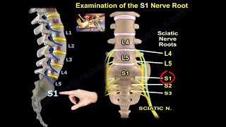 Examination Of S1 Nerve Root  Everything You Need To Know  Dr Nabil Ebraheim [upl. by Malchus]