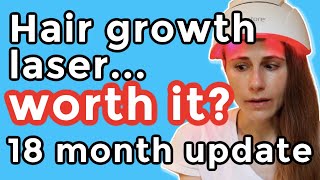 iRestore hair growth laser 18 month update Is it worth it Dr Dray [upl. by Nwatna]