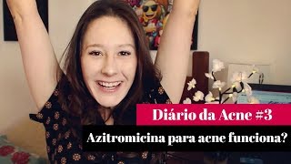 Antibiótico Azitromicina para ACNE  por Letícia Menezes [upl. by Divadleahcim]