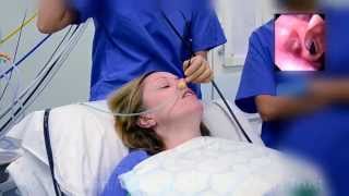 Awake Fibreoptic Intubation  patient education video [upl. by Orhtej]