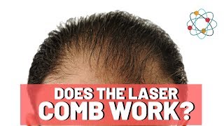 Laser Combs For Hair Loss  Is It Worth It [upl. by Hsetirp455]