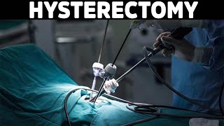 Hysterectomy Risks and Side Effects [upl. by Hsreh251]