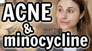 Minocycline versus doxycycline for acne Dr Dray [upl. by Iras646]