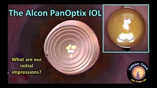 Review of the Alcon PanOptix lens for Cataract Surgery [upl. by Avehs]