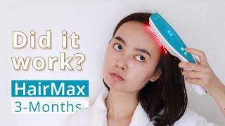 Did It Work HairMax Laser Comb 3 Month Update [upl. by Lilah]