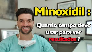 Minoxidil quanto tempo devo usar para ter resultado [upl. by Laural]