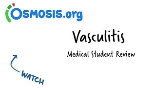 Vasculitis  Clinical Presentation [upl. by Barram]