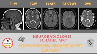 MRT Kopf Die wichtigsten Sequenzen [upl. by Verne]