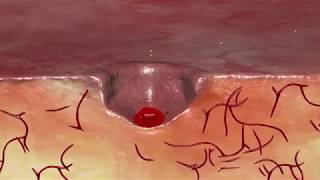 FLOSEAL Hemostatic Matrix Mechanism of Action [upl. by Ramyar]