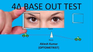 4 Prism Base Out Test [upl. by Grochow]