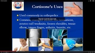 Your guide to cortisone injections [upl. by Anwahsad72]