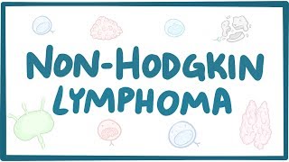 Nonhodgkin lymphoma  causes symptoms diagnosis treatment pathology [upl. by Antony]