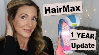 HairMax Laserband 82  1 Year Hair Growth Update [upl. by Treulich]