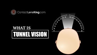 Whats Tunnel Vision Symptoms and Loss of Peripheral Vision [upl. by Remled768]