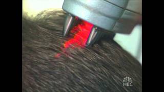 HairMax LaserComb tested on Dateline NBC  The Follicle 5  Part 5 [upl. by Jana252]