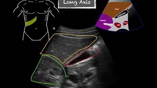 POCUS  Gallbladder Ultrasound Anatomy [upl. by Nahtad665]