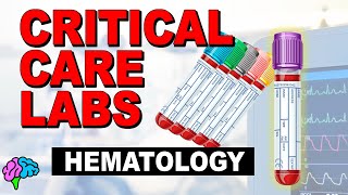 How to Interpret RBC Indices eg hemoglobin vs hematocrit MCV RDW [upl. by Gustavus459]