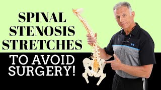 Best 3 Stretches To Quickly Remedy Lumbar Spinal Stenosis amp Avoid Surgery [upl. by Tingey]