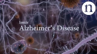 Inside Alzheimer’s disease [upl. by Nolyag]